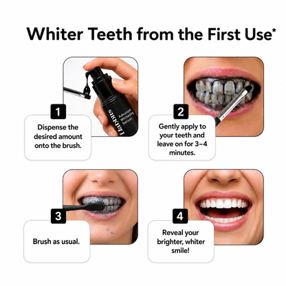Advance Teeth Whitening Serum (30 ml)