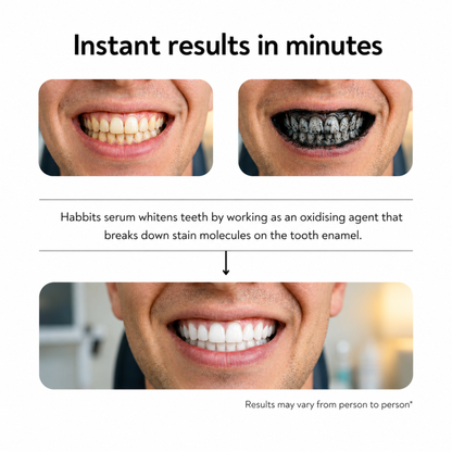 Advance Teeth Whitening Serum (30 ml)