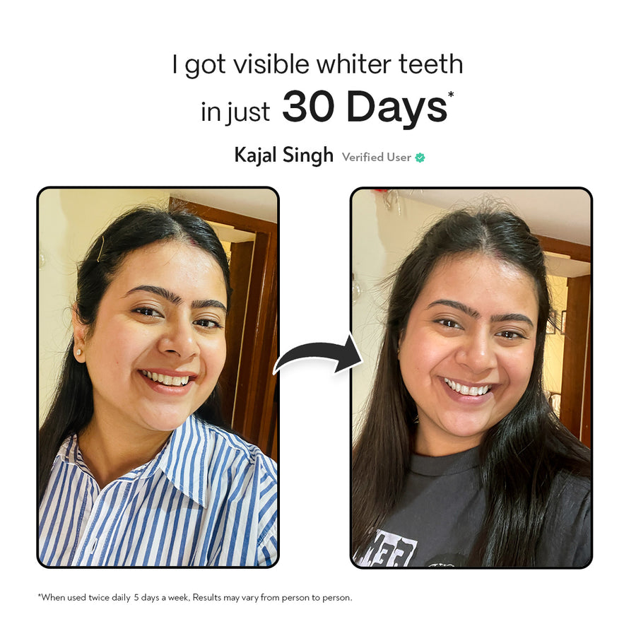 Customer whitening result